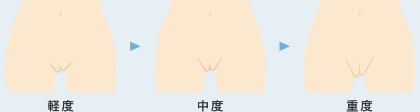 大陰唇とは？